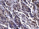 RAN Antibody in Immunohistochemistry (Paraffin) (IHC (P))