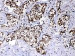 RAN Antibody in Immunohistochemistry (Paraffin) (IHC (P))