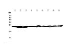 RAN Antibody in Western Blot (WB)