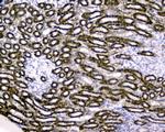 RBP4 Antibody in Immunohistochemistry (Paraffin) (IHC (P))