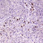 RNASE3 Antibody in Immunohistochemistry (Paraffin) (IHC (P))