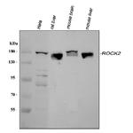 ROCK2 Antibody in Western Blot (WB)