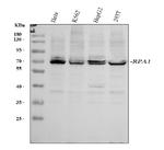 RPA70 Antibody in Western Blot (WB)