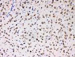 MPS1 Antibody in Immunohistochemistry (Paraffin) (IHC (P))