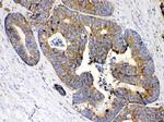 MPS1 Antibody in Immunohistochemistry (Paraffin) (IHC (P))