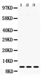 MPS1 Antibody in Western Blot (WB)