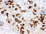 RRM2 Antibody in Immunohistochemistry (Paraffin) (IHC (P))