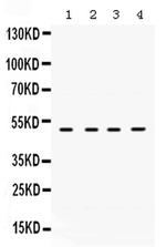 RRM2 Antibody in Western Blot (WB)