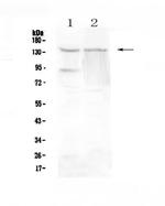 RTEL1 Antibody in Western Blot (WB)