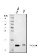 S100A8 Antibody in Western Blot (WB)