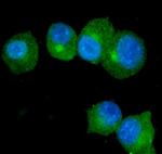 S100A9 Antibody in Immunocytochemistry (ICC/IF)