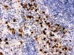 S100A9 Antibody in Immunohistochemistry (Paraffin) (IHC (P))