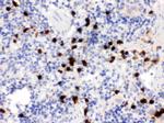 S100A9 Antibody in Immunohistochemistry (Paraffin) (IHC (P))