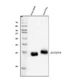 S100A9 Antibody in Western Blot (WB)