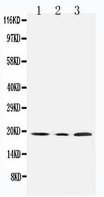 SDHC Antibody in Western Blot (WB)