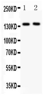 P-Selectin (CD62P) Antibody in Western Blot (WB)