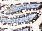 Maspin Antibody in Immunohistochemistry (Paraffin) (IHC (P))