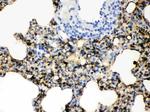 SFTPA1/SFTPA2 Antibody in Immunohistochemistry (Paraffin) (IHC (P))