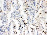 SFTPA1/SFTPA2 Antibody in Immunohistochemistry (Paraffin) (IHC (P))