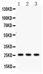 SFTPA1/SFTPA2 Antibody in Western Blot (WB)