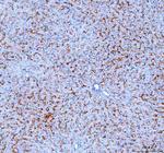 NTCP Antibody in Immunohistochemistry (Paraffin) (IHC (P))