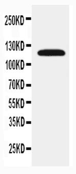 SLC12A1 Antibody in Western Blot (WB)