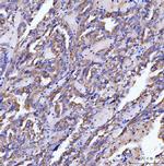 SLC12A1 Antibody in Immunohistochemistry (Paraffin) (IHC (P))