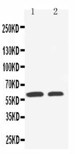 SLC22A1 Antibody in Western Blot (WB)