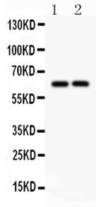 SLC22A2 Antibody in Western Blot (WB)