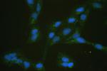 GLUT5 Antibody in Immunocytochemistry (ICC/IF)