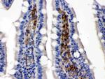 GLUT5 Antibody in Immunohistochemistry (Paraffin) (IHC (P))