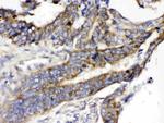 GLUT5 Antibody in Immunohistochemistry (Paraffin) (IHC (P))