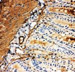 GLUT5 Antibody in Immunohistochemistry (Frozen) (IHC (F))