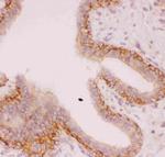 Nhe-1 Antibody in Immunohistochemistry (Paraffin) (IHC (P))