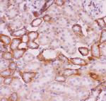 Nhe-1 Antibody in Immunohistochemistry (Paraffin) (IHC (P))