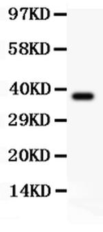 Nhe-1 Antibody in Western Blot (WB)