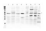 SMAD1/SMAD5 Antibody in Western Blot (WB)