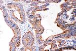 SMAD5 Antibody in Immunohistochemistry (Paraffin) (IHC (P))