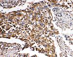 SMAD5 Antibody in Immunohistochemistry (Paraffin) (IHC (P))