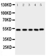 SMAD5 Antibody in Western Blot (WB)