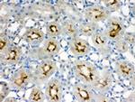 SMC3 Antibody in Immunohistochemistry (Paraffin) (IHC (P))