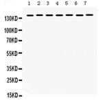 SMC3 Antibody in Western Blot (WB)