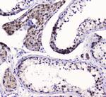 SMC6 Antibody in Immunohistochemistry (Paraffin) (IHC (P))