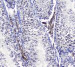 SMC6 Antibody in Immunohistochemistry (Paraffin) (IHC (P))