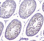 SMC6 Antibody in Immunohistochemistry (Paraffin) (IHC (P))