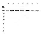 SMC6 Antibody in Western Blot (WB)