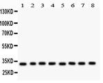 SMN1/SMN2 Antibody in Western Blot (WB)