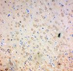 SOD2 (MnSOD) Antibody in Immunohistochemistry (Paraffin) (IHC (P))