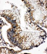 SOD2 (MnSOD) Antibody in Immunohistochemistry (Paraffin) (IHC (P))