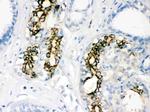 SOD2 (MnSOD) Antibody in Immunohistochemistry (Paraffin) (IHC (P))